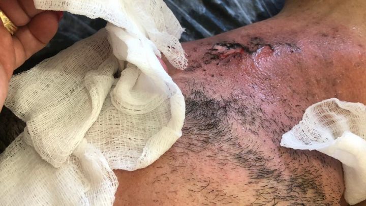 HOMEM FICA FERIDO APÓS CAIXA DE SOM EXPLODIR