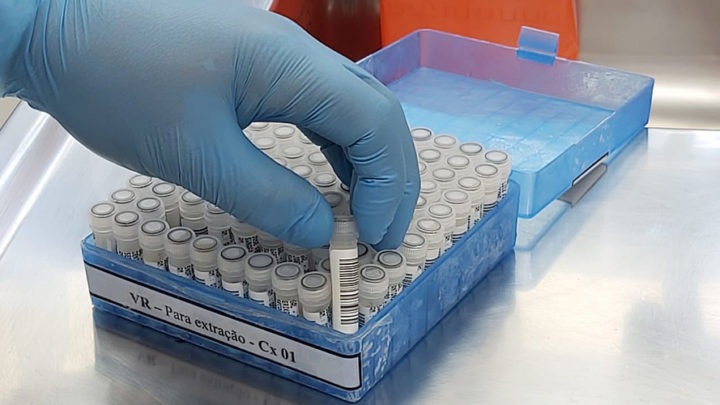 Saiba como é feito o exame para detectar o novo coronavírus no Paraná