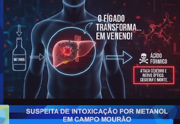 SUSPEITA DE INTOXICAÇÃO POR METANOL EM CAMPO MOURÃO
