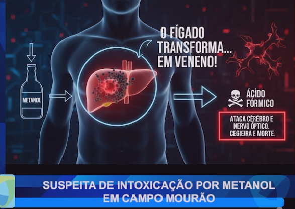 SUSPEITA DE INTOXICAÇÃO POR METANOL EM CAMPO MOURÃO