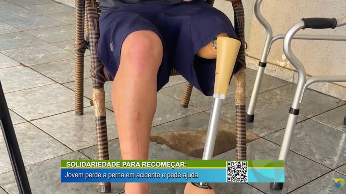 SOLIDARIEDADE PARA RECOMECA JOVEM PERDE A PERNA EM ACIDENTE E PEDE AJUDA